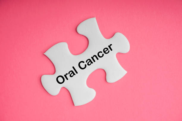 Puzzle piece with "Oral Cancer" written on it in front of a pink background.
