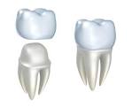 Dental Crowns Park Ridge, IL